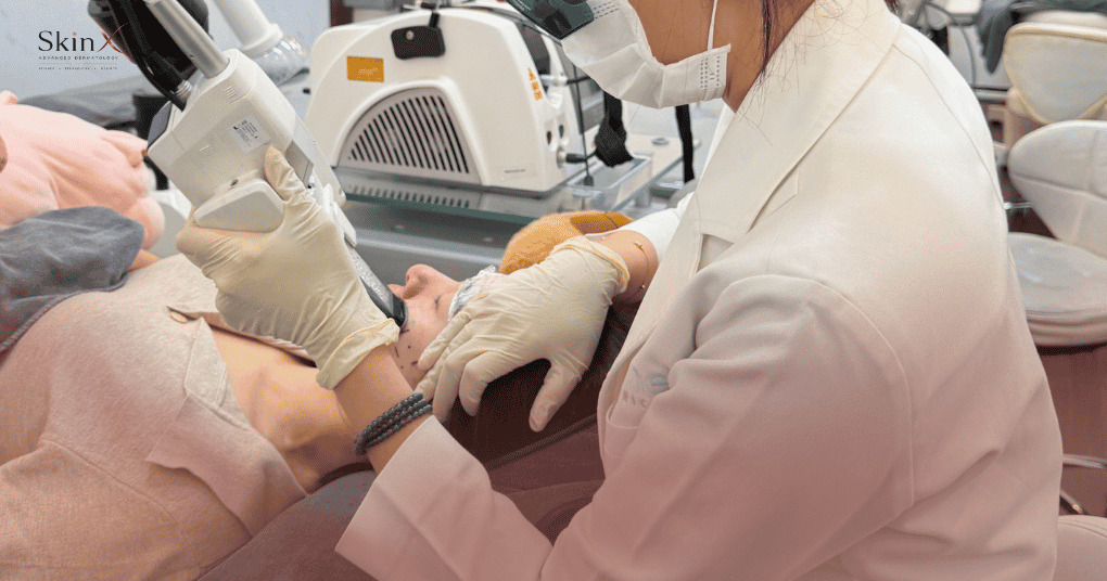 Laser Accure là gì? Công nghệ 1726nm kiểm soát tuyến nhờn